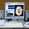 Computer-enhances trans-cranial doppler 